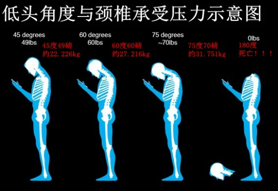 动态热力图展示不同姿势下颈椎压力分布